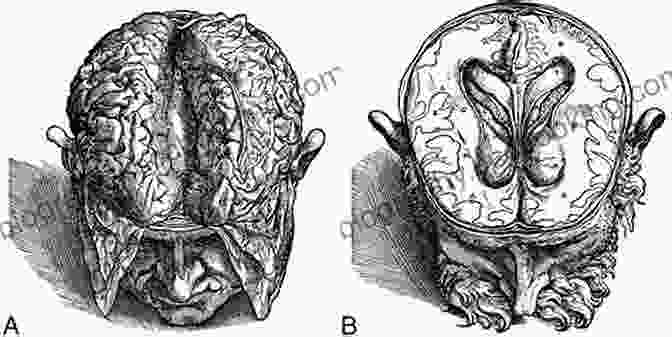 Andreas Vesalius Dissecting A Human Brain, Drawing From The 16th Century. A History Of The Human Brain: From The Sea Sponge To CRISPR How Our Brain Evolved