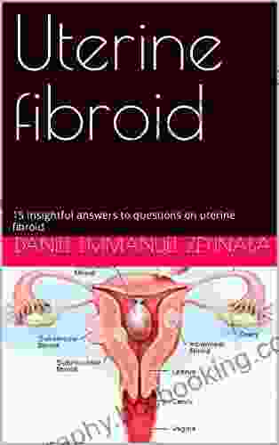 Uterine Fibroid: 15 Insightful Answers To Questions On Uterine Fibroid